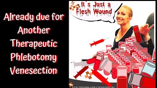 Already need a phlebotomy venesection in less than a week CBC is strange polycythemia Vera [upl. by Itnavart406]