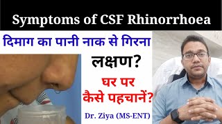 CSF Rhinorrhea घर पर कैसे पहचानें Naak se Pani aana Leaking of brain fluid through nose [upl. by Renraw]