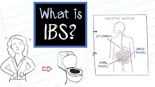 What is IBS Irritable Bowel Syndrome [upl. by Lebasiram547]