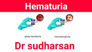 Approach To Hematuria  Types amp Management Dr Sudharsan [upl. by Bonucci881]