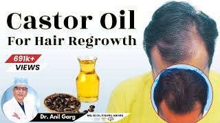 Is Castor Oil Good For Hair Growth  बाल Regrowth के लिए Castor Oil का उपयोग करे  Dr Anil Garg [upl. by Can201]