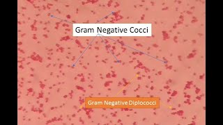 Gram negative cocci under microscope Gram negative diplococci Neisseria under microscope GNC [upl. by Atnuahc292]