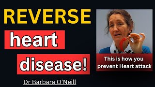 Dr Barbara ONeill Reveals 5 Shocking Foods To REVERSE HEART DISEASE [upl. by Danete]