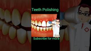 teeth polishing shorts viral dental [upl. by Eizzil]