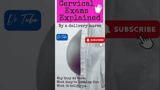 What do the Cervical Exam Numbers Mean pregnancy cervical pain [upl. by Irovi]