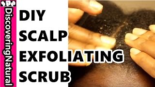 DIY Scalp Scrub for Exfoliating Scalp Health [upl. by Ardnassak466]