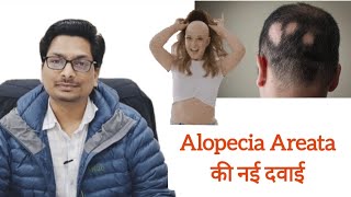 Alopecia Areata की नई दवाई  Tofacitinib  Baricitinib  Ruxolitinib  गंजापन का नया इलाज़ alopecia [upl. by Orelu900]