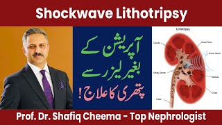 Lithotripsy for Kidney Stones  Shockwave lithotripsy  SWL ESWL SWL lithotripsy [upl. by Paxon]