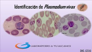 Identifica Plasmodium vivax EN 3 MINUTOS [upl. by Relyk709]