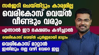 ഈ ഭക്ഷണം കഴിച്ചാൽ വെരികോസ് വെയ്ൻ പൂർണ്ണമായി മാറ്റാം varicose vein malayalam [upl. by Onimixam464]