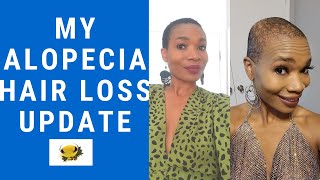 Alopecia diagnosis  update journey  patience is a virtue [upl. by Keele551]