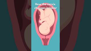 How the Cervix Changes in Labor laboranddelivery [upl. by Langsdon851]