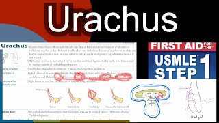 Urachus Patent Urachus Urachal cyst Vesicourachal diverticulum in HindiUrdu by first aid [upl. by Suez]