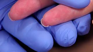 Perform a Capillary Puncture Obtain a Blood Sample by Capillary Puncture [upl. by Enrak670]