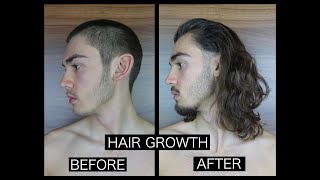 HAIR GROWTH TIME LAPSE  SIDE [upl. by Levitus]