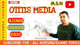 otitis media in hindi  all about otitis media  Nurses Tech Online  medical surgical nursing [upl. by Annayehc]