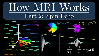 How MRI Works  Part 2  The Spin Echo [upl. by Enrobyalc]