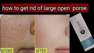 ऑयली स्किन और large open porse के लिए बेस्ट serum  oily skin care  sebuna ac serum [upl. by Attiuqaj]