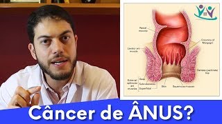 O que você sabe sobre o CÂNCER de ânus  Dr Marcelo Werneck [upl. by Acnaiv216]