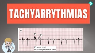 How to dignose Abnormal heart rhythm Tachyarrythmias On ECG  Step by step [upl. by Earas]