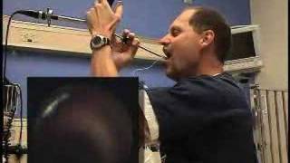 Airway RIFL Intubation [upl. by Sidonius]