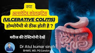 क्या अल्सरेटिव कोलाइटिस होम्योपैथिक इलाज से ठीक होता है  Ulcerative Colitis  Dr Atul Kumar Singh [upl. by Asyla]