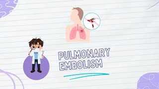 Pulmonary embolism Pathophysiology Types diagnosis amp Treatment [upl. by Gordie737]