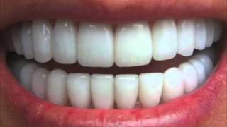 Get Perfectly Straight Teeth―∎ affirmations  Cure Overbite Underbite amp Crossbite [upl. by Nevaed995]