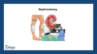 Nephrostomy [upl. by Haran]