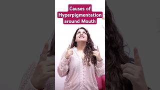 Causes of Hyperpigmentation around Mouth  Pigmentation Treatment in South Delhi  Soul Derma Clinic [upl. by Atsyrt903]