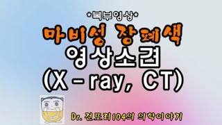 마비성 장폐색증paralyticadynamic ileus 영상소견abdominal Xray CT [upl. by Aleel829]