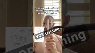 VOR training vestibular [upl. by Trude535]