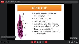 Clonorchis sinensis và Opisthorchis viverrinii  Sán lá gan nhỏ  ký sinh trùng  Y2 [upl. by Jadd]