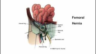 femoral triangle [upl. by Seabury]