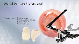 Digital Denture – first Appointment [upl. by Gerlac]