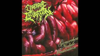 Cerebral Incubation  Gonhorrea Nodule Mastication Full Album 2012 HD [upl. by Rika]