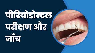 पीरियोडोन्टल परीक्षण और जाँच  Periodontal Examination and Probing in Hindi [upl. by Nabla924]