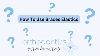 How to Use Braces Elastics [upl. by Lesak]