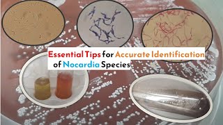 Essential Tips for Accurate Identification of Nocardia Species [upl. by Ramiah]