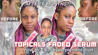 I used the TOPICALS FADED serum for 6 MONTHS and this happened [upl. by Christian635]