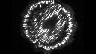 Paxillin dynamics during focal adhesion formation [upl. by Rob]