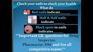 Check your nails to check your healthQuiz13Imp GK for DSC Pharmacist Drug Inspector amp all exams [upl. by Revlis]