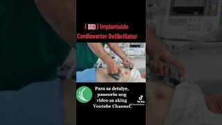 Implantable Cardioverter Defibrillator ICD [upl. by Schilling]