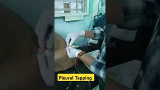 Pleural Tapping procedure viralshorts drsatyampathak medicotips doctor tuberculosis [upl. by Berlin]