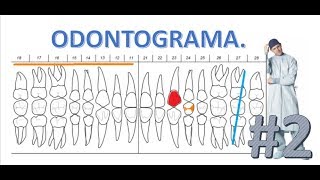 Como llenar un Odontograma  Parte 2 [upl. by Sualokcin548]