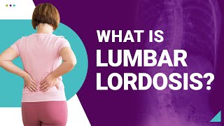 What is Lumbar Lordosis [upl. by Nadruoj]