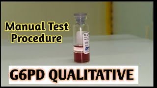 G6PD Qualitative test  G6PD Qualitative test procedure [upl. by Yadrahs]