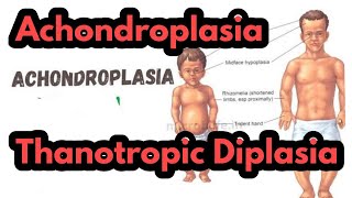 AchondroplasiaThanotropic DiplasiaDifference between Achondroplasia and Thanotropic DiplasiaRobin [upl. by Eiramnna40]