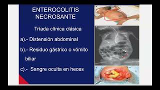 Enterocolitis necrotizante para el ENARM 2024 [upl. by Chucho491]