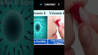 vitamin deficiency diseases vitamin deficiency [upl. by Assital]